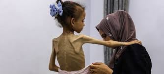 Gaza Famine Toll Rises: 117 Children Dead as World Stands By