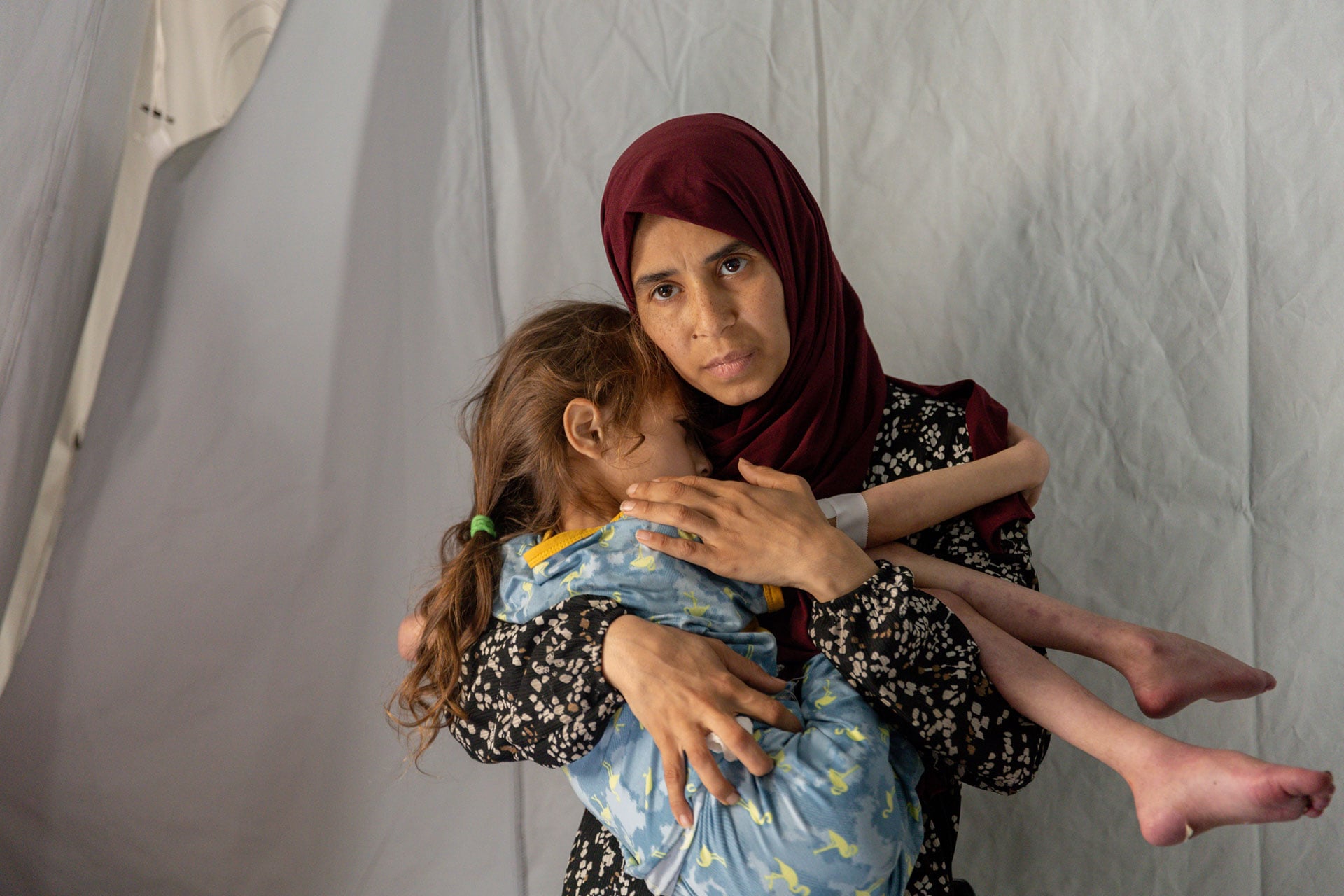 UNICEF Warns of High Malnutrition Rates Threatening Gaza’s Children