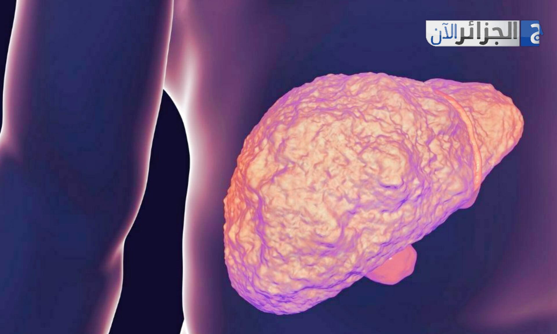 High-Fat Diets Linked to Accelerated Liver Cancer Risk