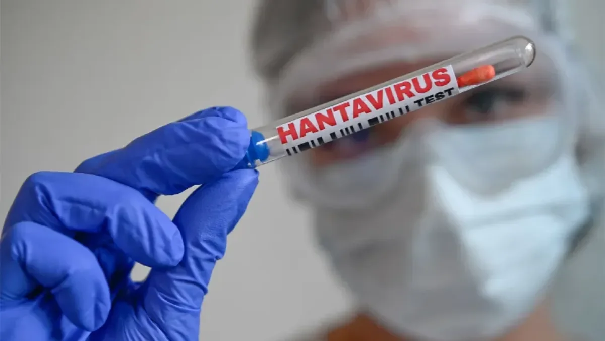 Algeria Activates Emergency Health Measures Against Hanta Virus Threat