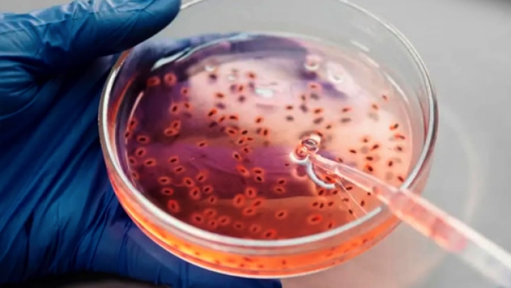 IARC Report Notes Algeria's Cancer Strategy Enhancements