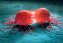 International Cancer Patient Congress Set for Algiers in 2026