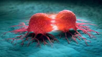 International Cancer Patient Congress Set for Algiers in 2026